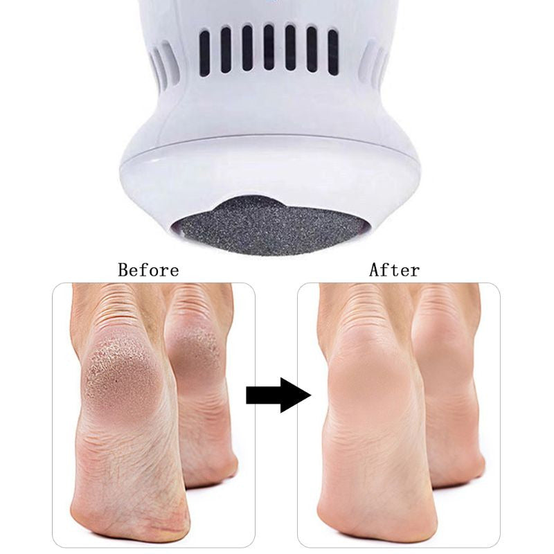 Electric Foot File & Callus Remover Vac