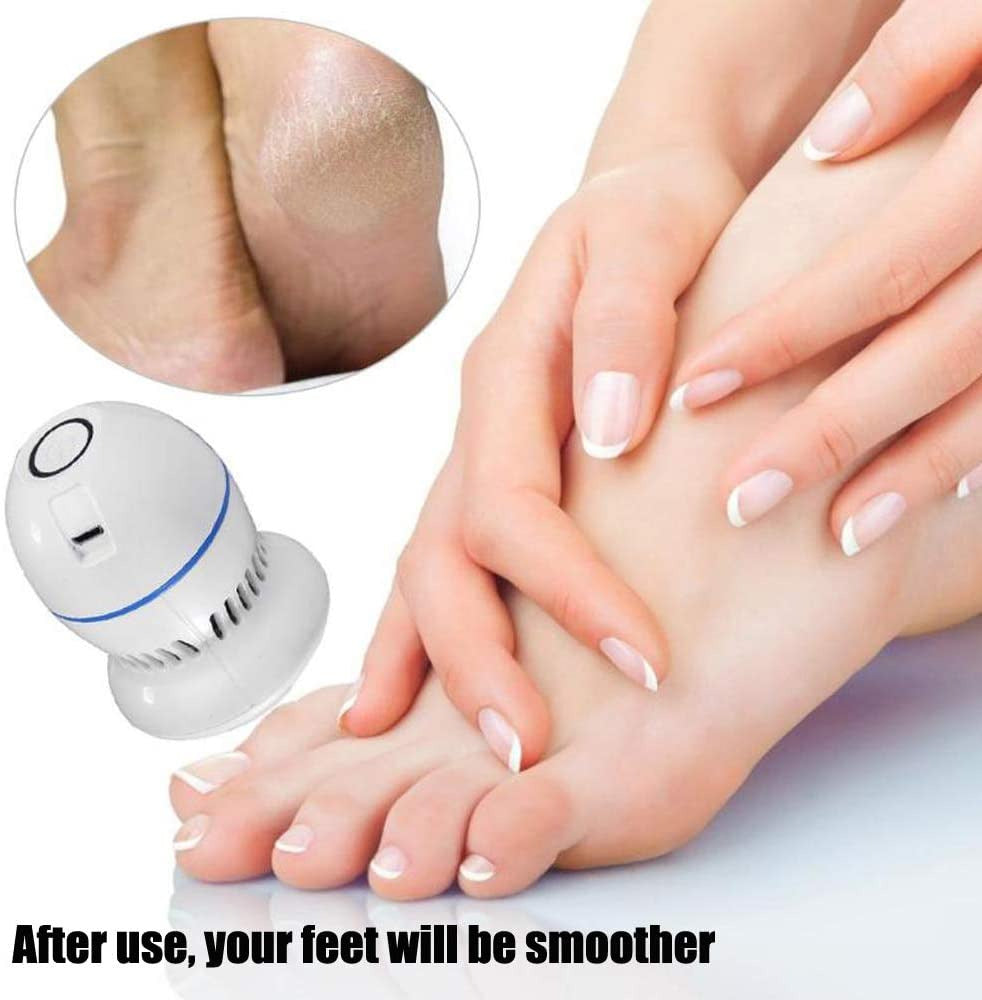 Electric Foot File & Callus Remover Vac