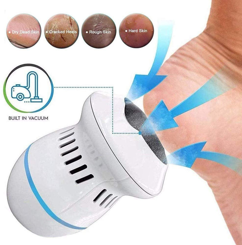 Pedi Vac Callus Remover for Feet with Built-in Vacuum Remove Dead Skin from  Feet